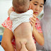 Oh! Deus: Bebê chinês de sete meses de idade nasce com “cauda” de 10 cm