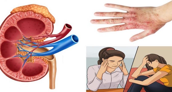 If Your Kidneys Are In Danger, These Are The 6 Signs You Shouldn’t Ignore