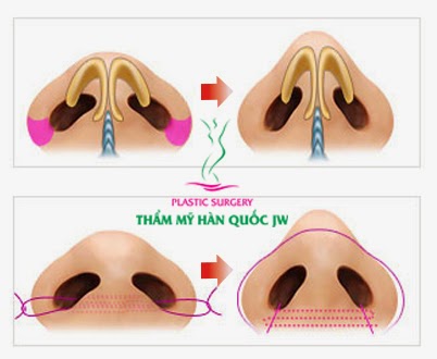 thu-gon-canh-mui-bao-lau-thi-lanh-2