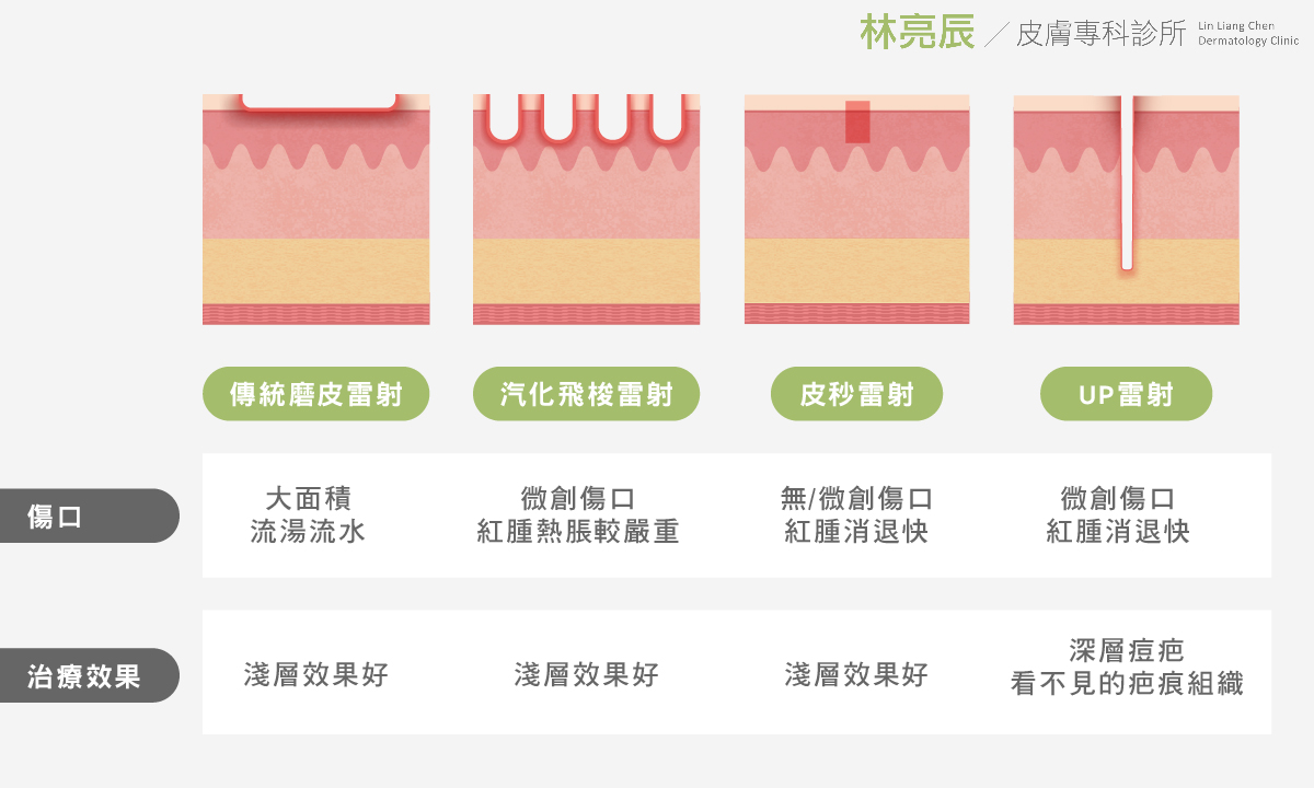 UP雷射痘疤治療凹疤治療痘痘印治療痘疤種類飛梭雷射皮秒雷射PICOSURE755蜂巢皮秒均勻膚色改善暗沉UltraPulse痘疤雷射汽化型雷射非汽化型雷射新竹醫美新竹皮膚科新竹林亮辰醫師