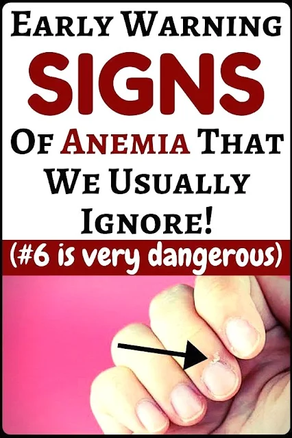 Early Warning Signs Of Anemia You Really Shouldn’t Ignore