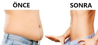 liposuction nedir neden yapılır