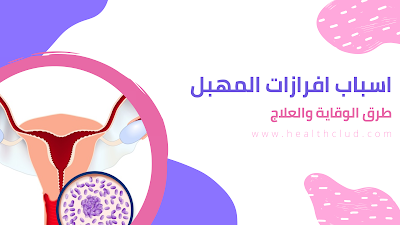 ما هي اسباب افرازات المهبل وما طرق الوقاية والعلاج؟