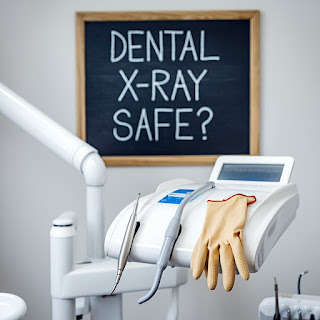 is dental x ray safe