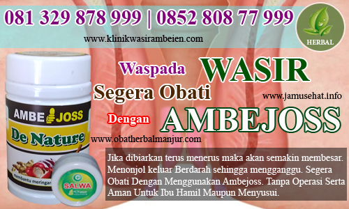 obat alami wasir eksternal