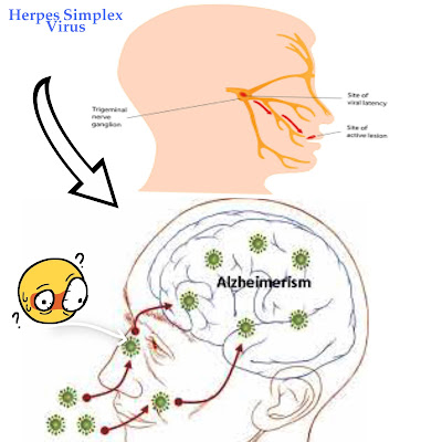 How to keep save from Herpes Simplex Virus.