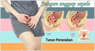 ALASAN WANITA DILARANG ANGKAT BERAT, SALAH SATUNYA DAPAT MENYEBABKAN PERANAKAN TURUN