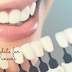 Know Who is The Perfect Candidate for Porcelain Veneers