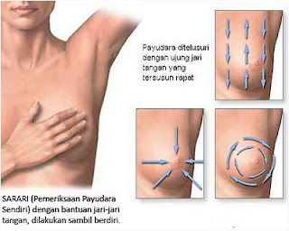 Cara Cek Kanker Payudara