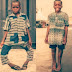 Young Boy Maurinho With Bow Legs Smiles After Undergoing Surgery