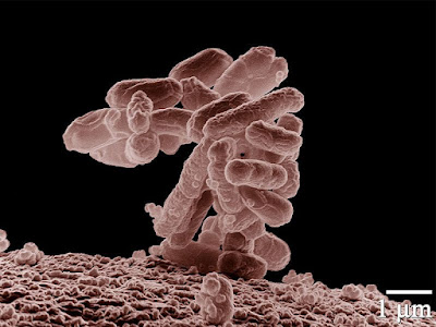 e coli bacteria