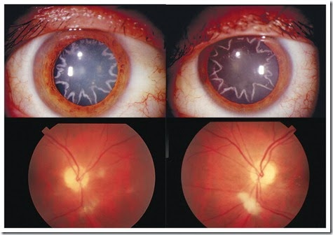 ojos estrella