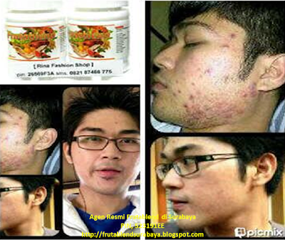 Stokis Frutablend Pasuruan 