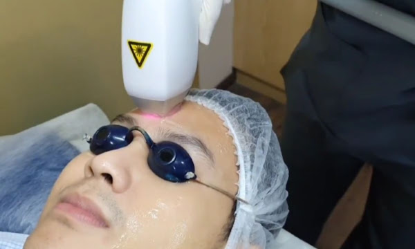 Cold Rejuvenation Laser Pure Laser Clinic