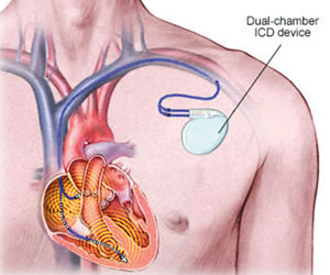 Cardiologist in Jalandhar