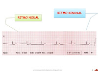 EKG RESOLUCION DE PROBLEMAS