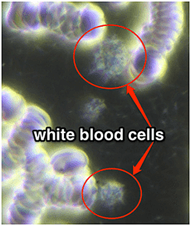 PEMF CHANGES BLOOD