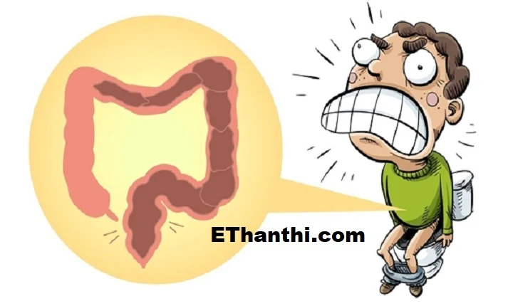 குடல் புற்றுநோய் பற்றி அறிந்து கொள்ள வேண்டிய முக்கிய அறிகுறிகள் !