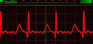 Cardiology Diseases