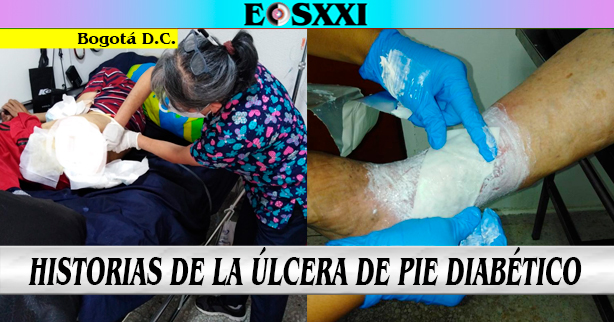 Una enfermera “curadora de heridas” y algunos de sus pacientes con Úlcera de Pie Diabético