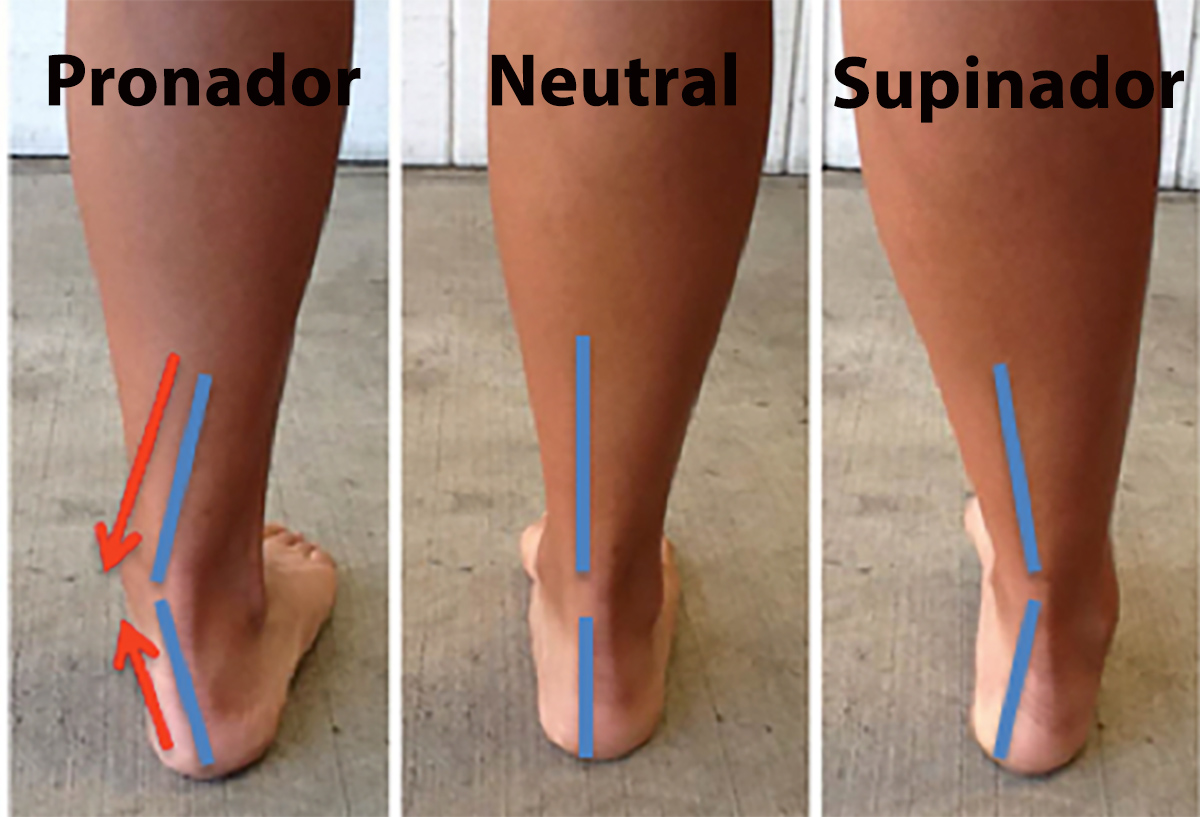Pronación vs supinación: qué es, cómo el calzado adecuado