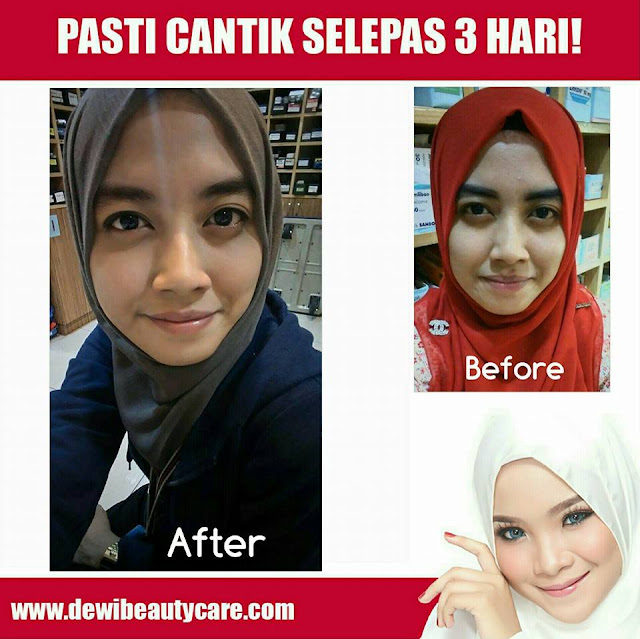 Dewi Beauty Care Skincare Murah