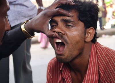 India’s Street Dentists