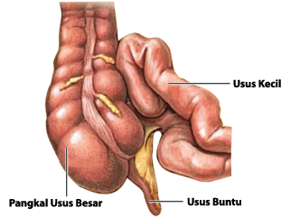 Penyebab Usus Buntu Dan Cara Mengatasinya [ www.BlogApaAja.com ]