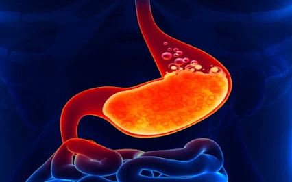 What is stomach acid?
