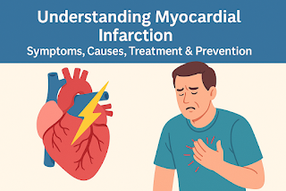 Understanding Myocardial Infarction