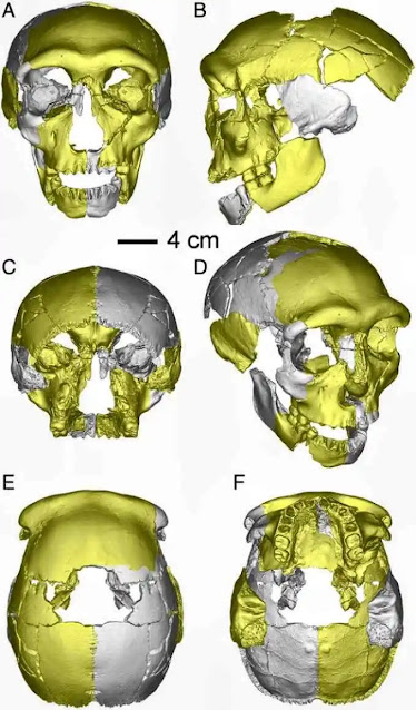 Reconstrucción de cráneo