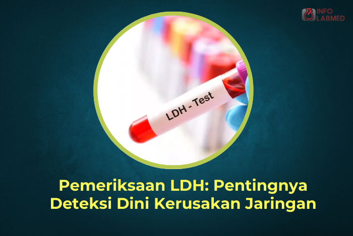 Pemeriksaan LDH: Pentingnya Deteksi Dini Kerusakan Jaringan