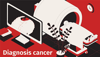 Cancer Diagnosis - Lungs Cancer Specialist in Delhi