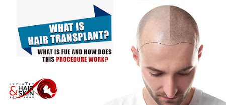 Hair Transplant