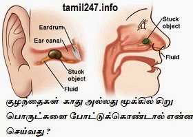 குழந்தைகள்  காது அல்லது மூக்கில் சிறு பொருட்களை போட்டுக்கொண்டால் என்ன செய்வது ?