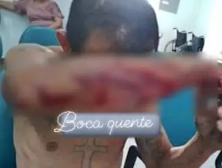 EM CAMOCIM-: , HOMEM TEM CASA INVADIDA E É ESPANCADO A PAULADAS ENQUANTO ESTAVA DORMINDO 