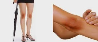 tips mengatasi lutut dan siku yang berwarna hitam dengan lemon, minyak zaitun, scrub serta pelembab