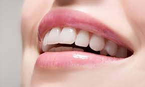 Bọc răng sứ cho độ trắng bóng tự nhiên