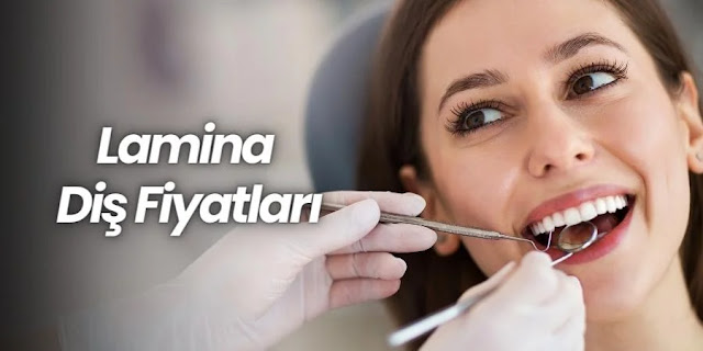 Lamina Diş Fiyatları - Diş Doktoru