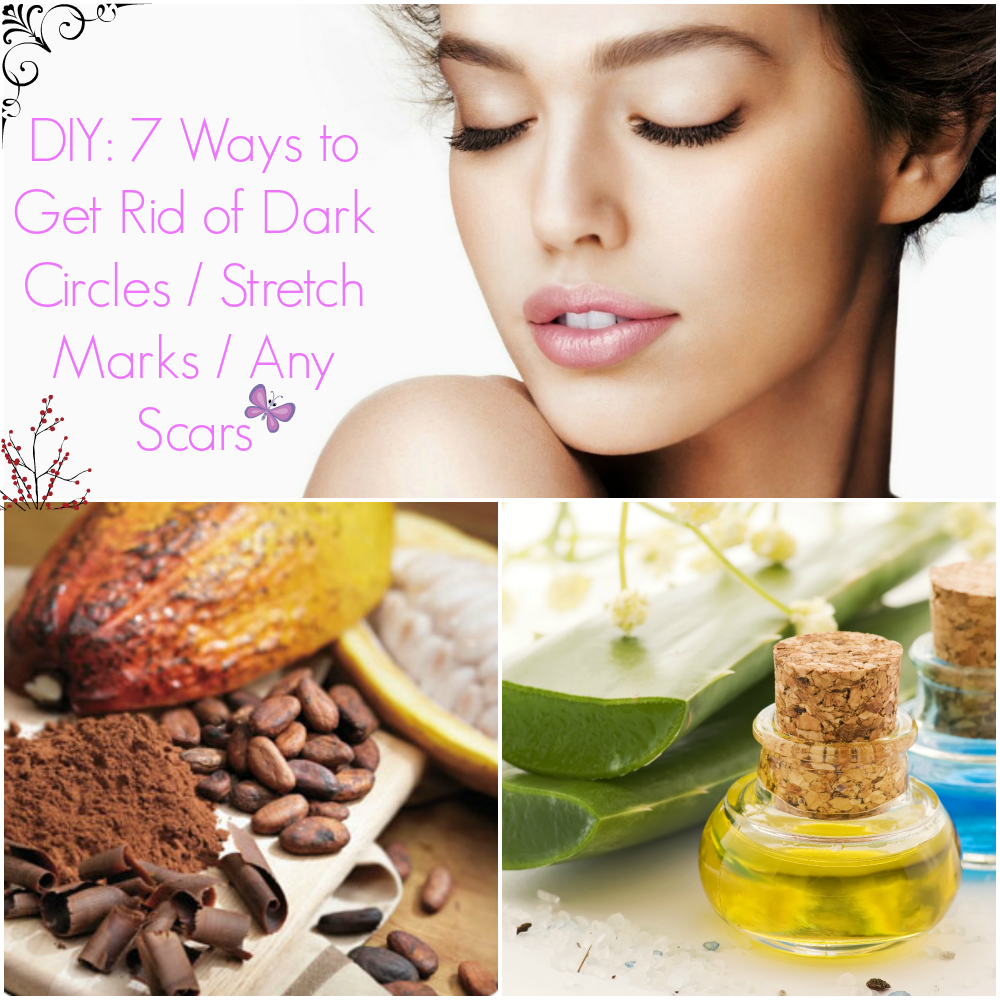 DIY: 7 ways to get rid of dark circles/ANY type of scar/Stretch Marks ...