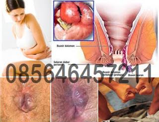 Harga 4 Paket AmbeJOSS Plus Salwa Lebih Murah