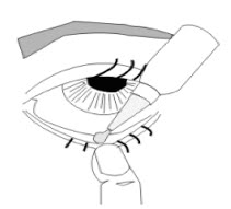 Sarazaqea: Cara-cara menggunakan Ubat Titik Mata (Eye Drops)