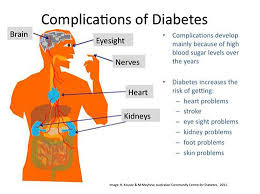 signs of diabetes, diabetes test, diabetes treatment, type 2 diabetes diet, juvenile diabetes