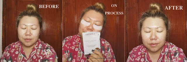 Lanore-Whitening-Hydrogel-Eye-Patch