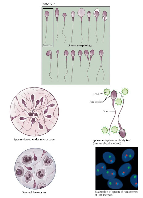 SEMEN ANALYSIS AND SPERM MORPHOLOGY