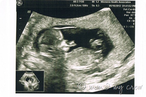 sono5102012CCF05132012_00000