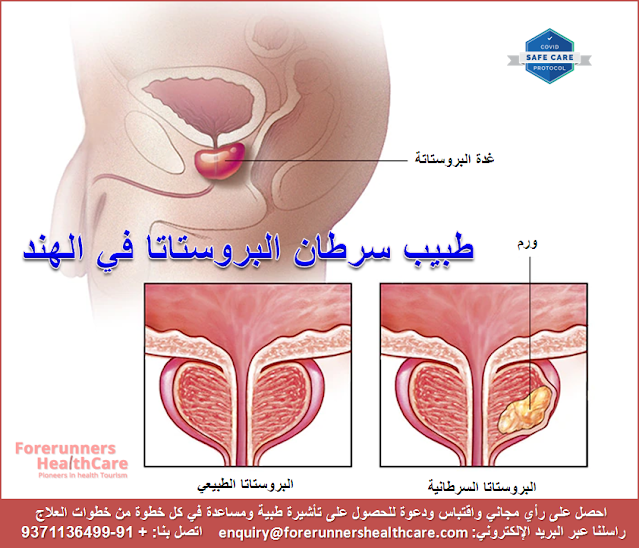 أفضل طبيب سرطان البروستاتا في الهند