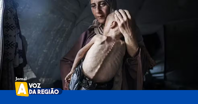 Por trás da imagem: A comovente história do bebê faminto de Gaza