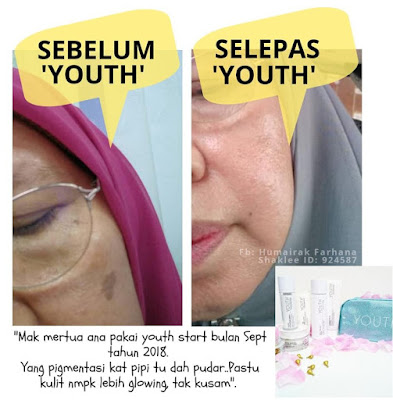 Testimoni Youth Skincare Pigmentasi Pudar, Kulit Glowing
