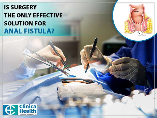 Best Fistula Surgeon in Kolkata